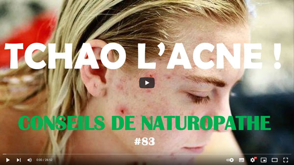 Tchao l’Acné ! Conseil de naturopathe